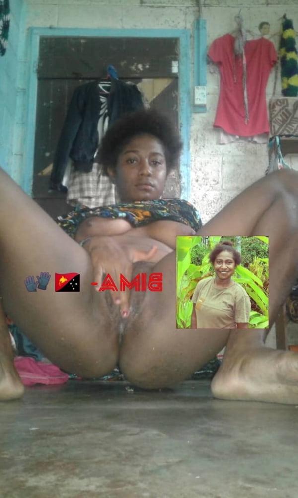 15P Bima 2