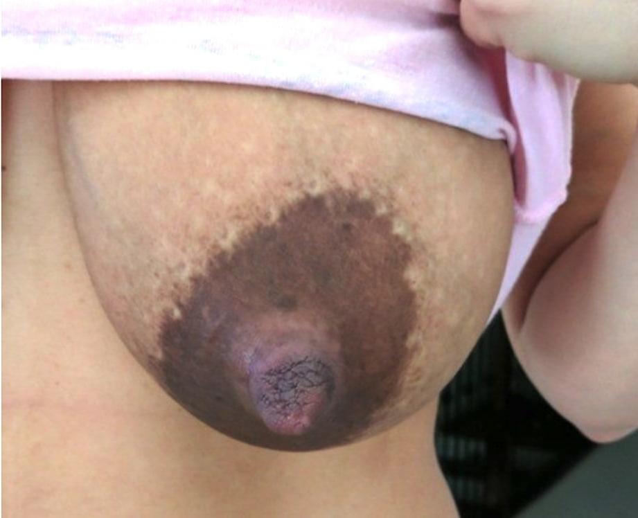 25P Massive Boobs Mommys #1 (StreetBoy2000)