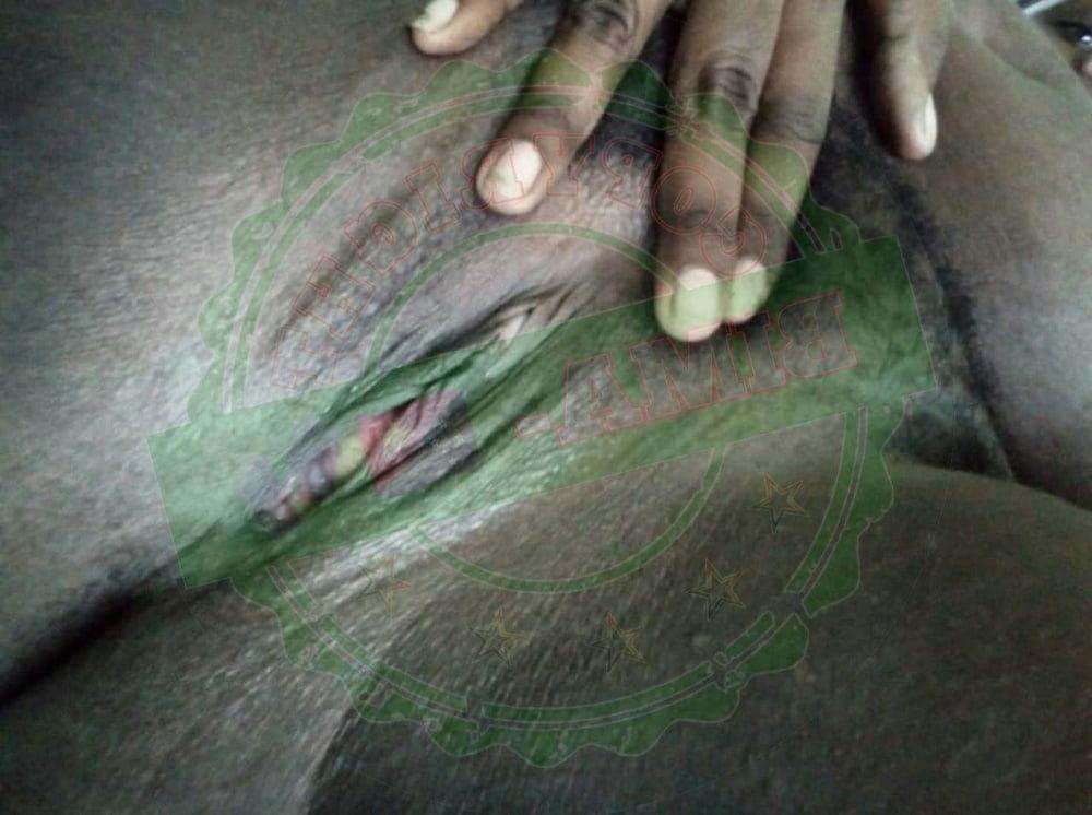25P Bima