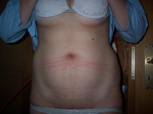 25P 4. German GF exposed by BF