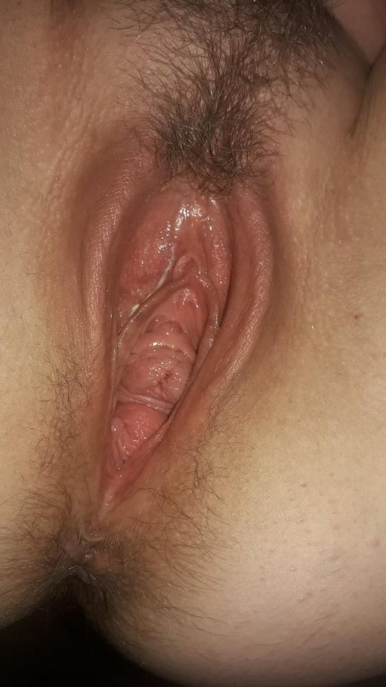 20P My Wife