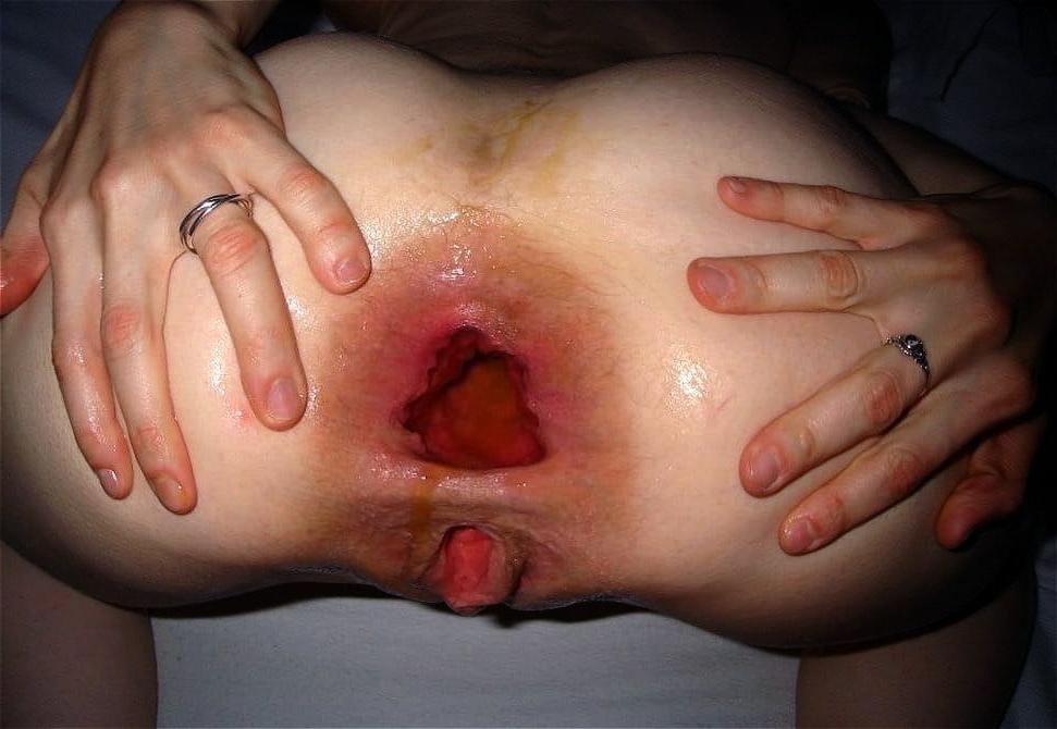 25P Perverted Pics 46