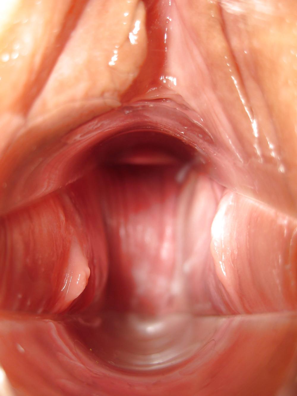 12P Speculum Pumped Pussy 