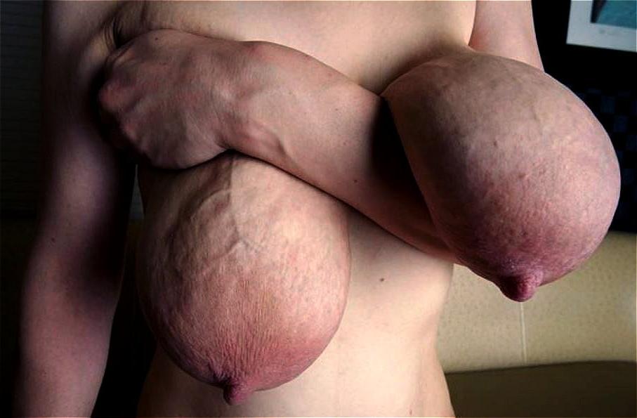 25P Perverted Pics 41