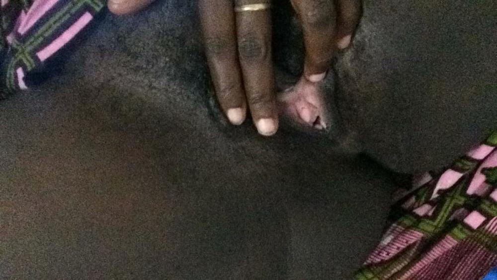 25P Plug anal