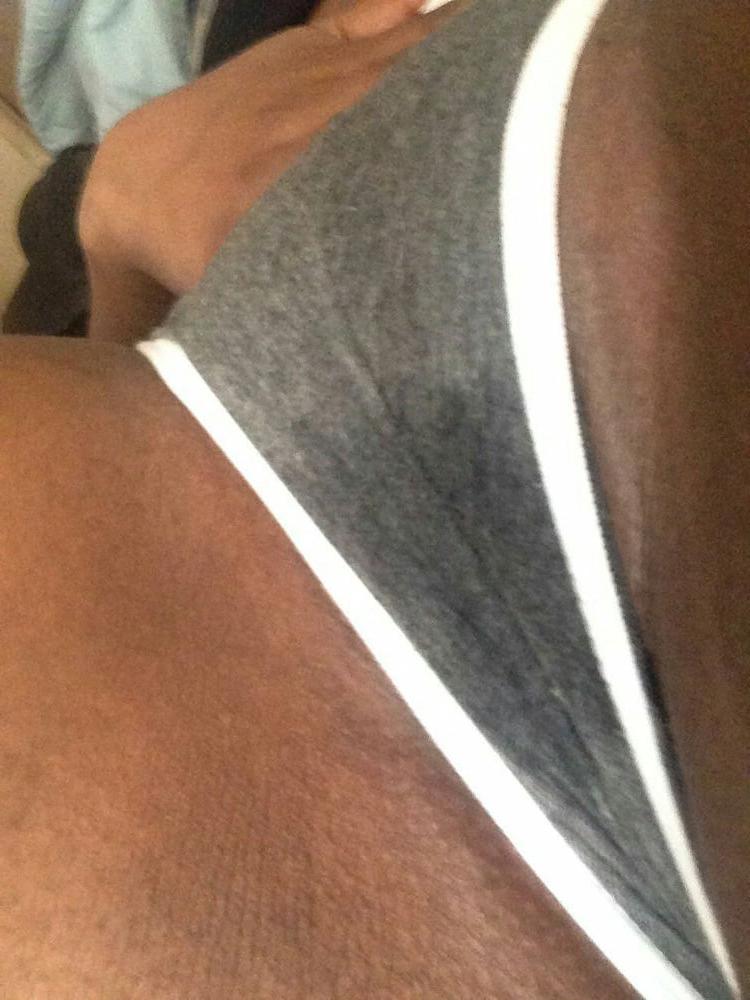 25P Plug anal