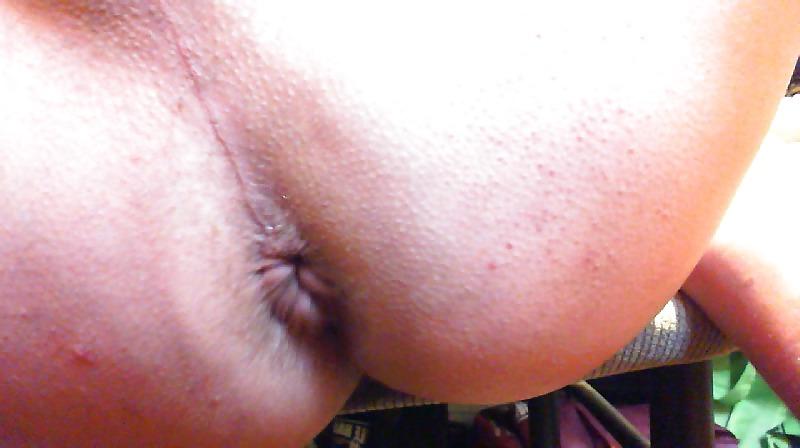 12P Hole