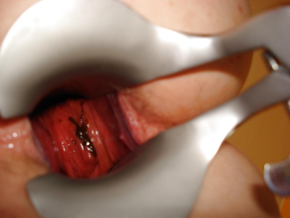 4P Speculum Spiele