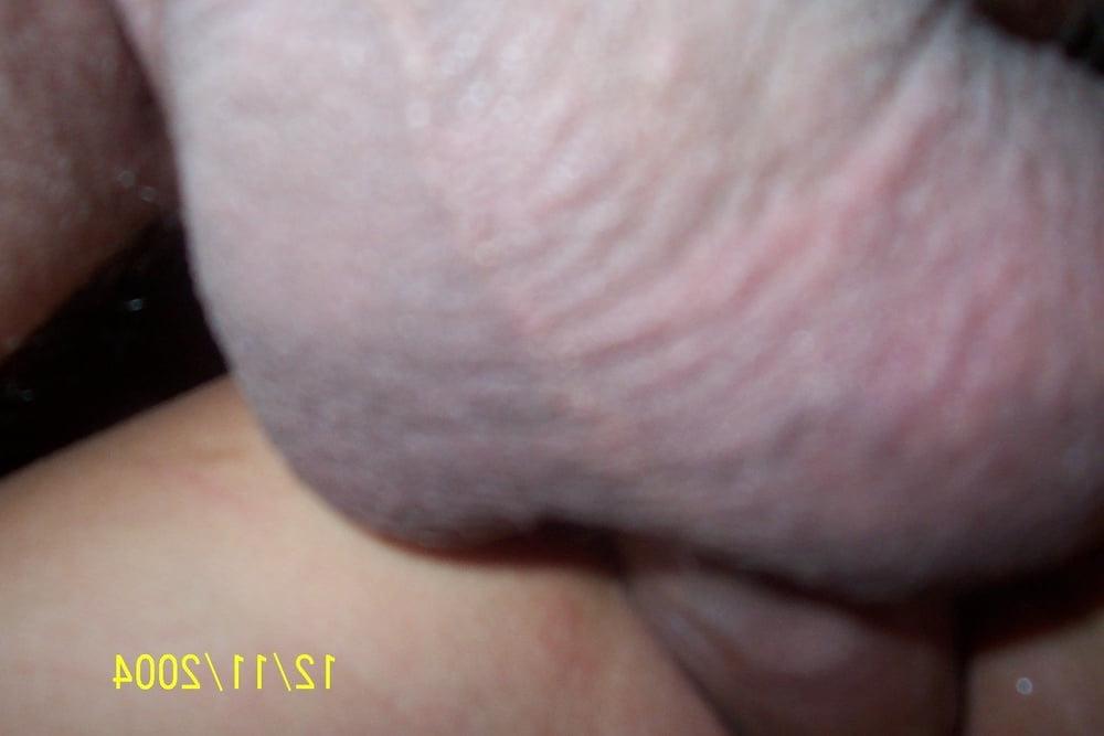 25P mature 564
