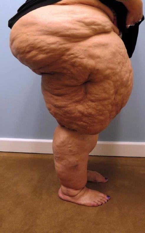 25P ssbbw