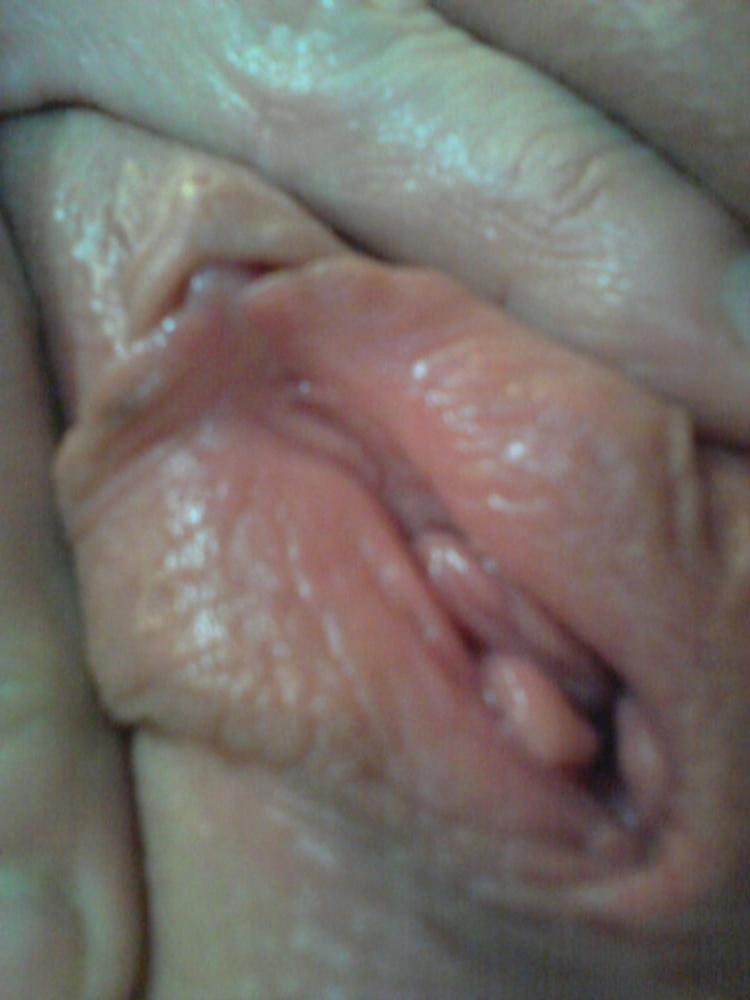 25P MATURE 224