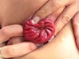 17P Ass