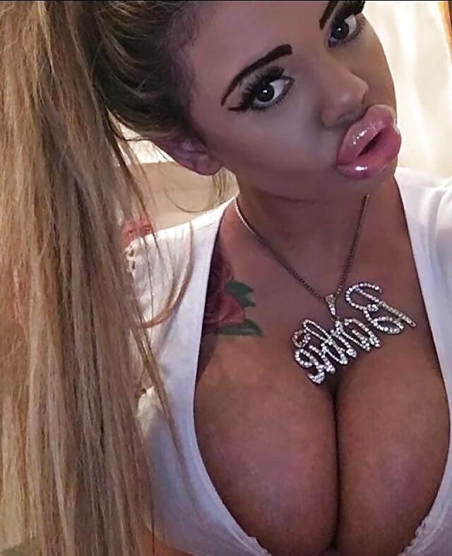 25P My Mom Enhanced Her Tits To Please Me - 01
