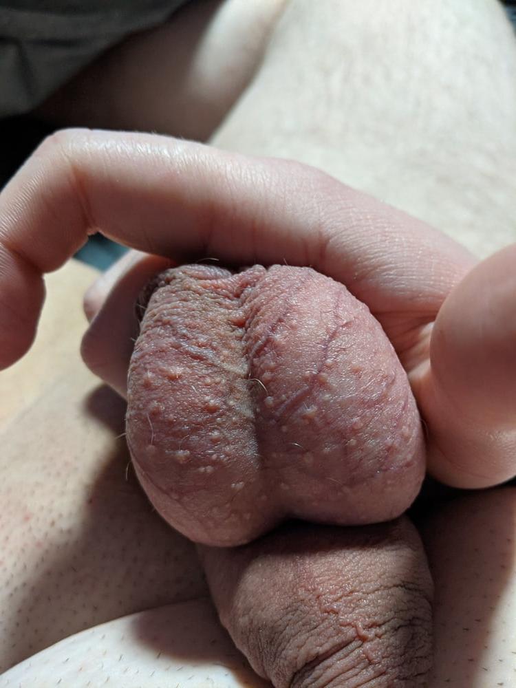 25P Ball Pictures #1 full of tasty cum