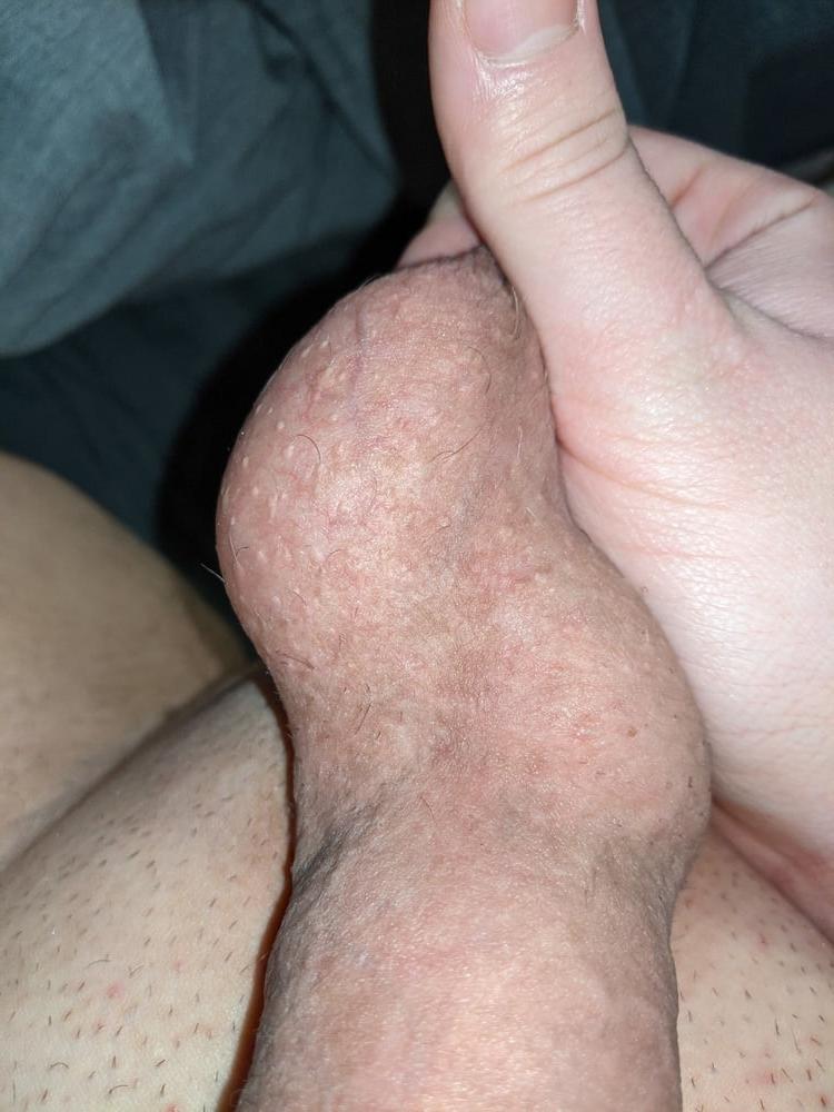 25P Ball Pictures #1 full of tasty cum