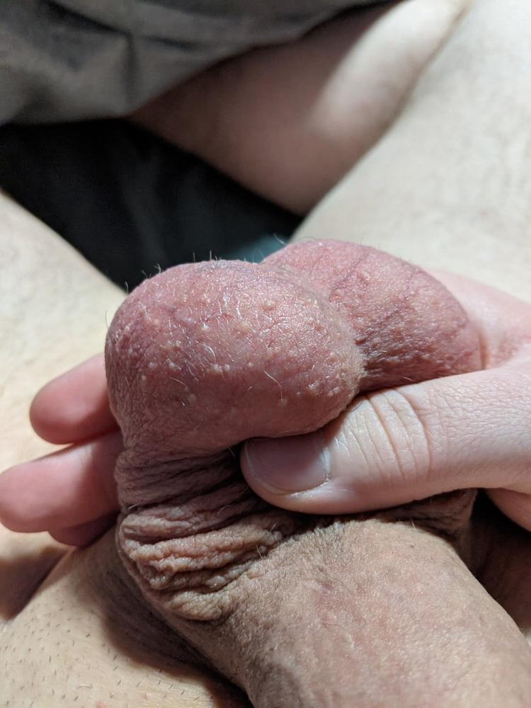25P Ball Pictures #1 full of tasty cum