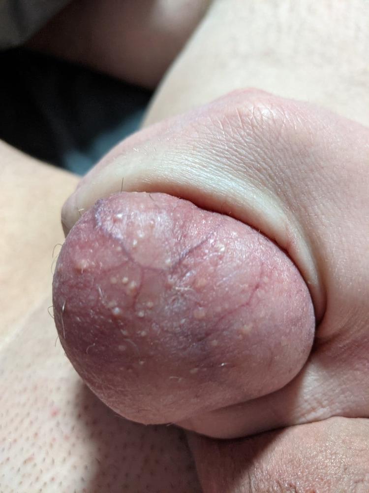 25P Ball Pictures #1 full of tasty cum