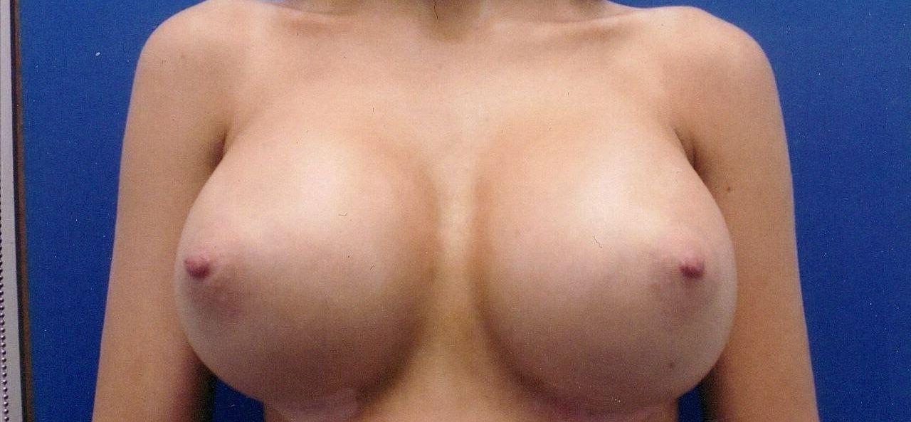 25P Nicole Thorne nude