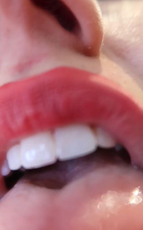 25P Colleen Ballinger nude