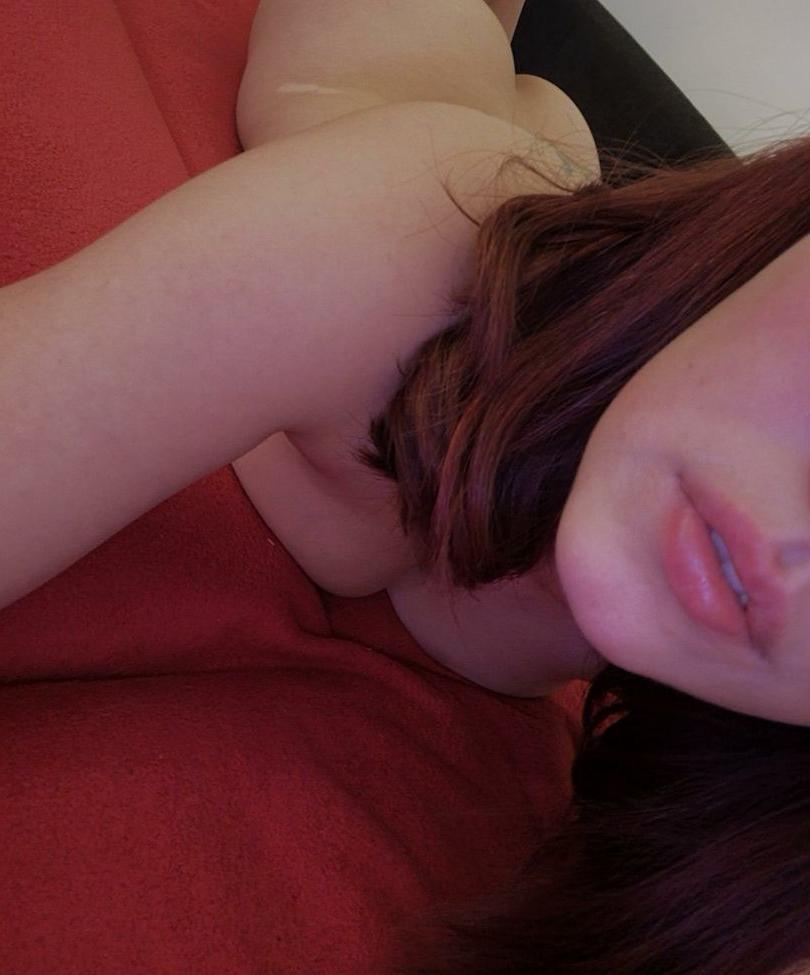 25P Vitiligo95 nude