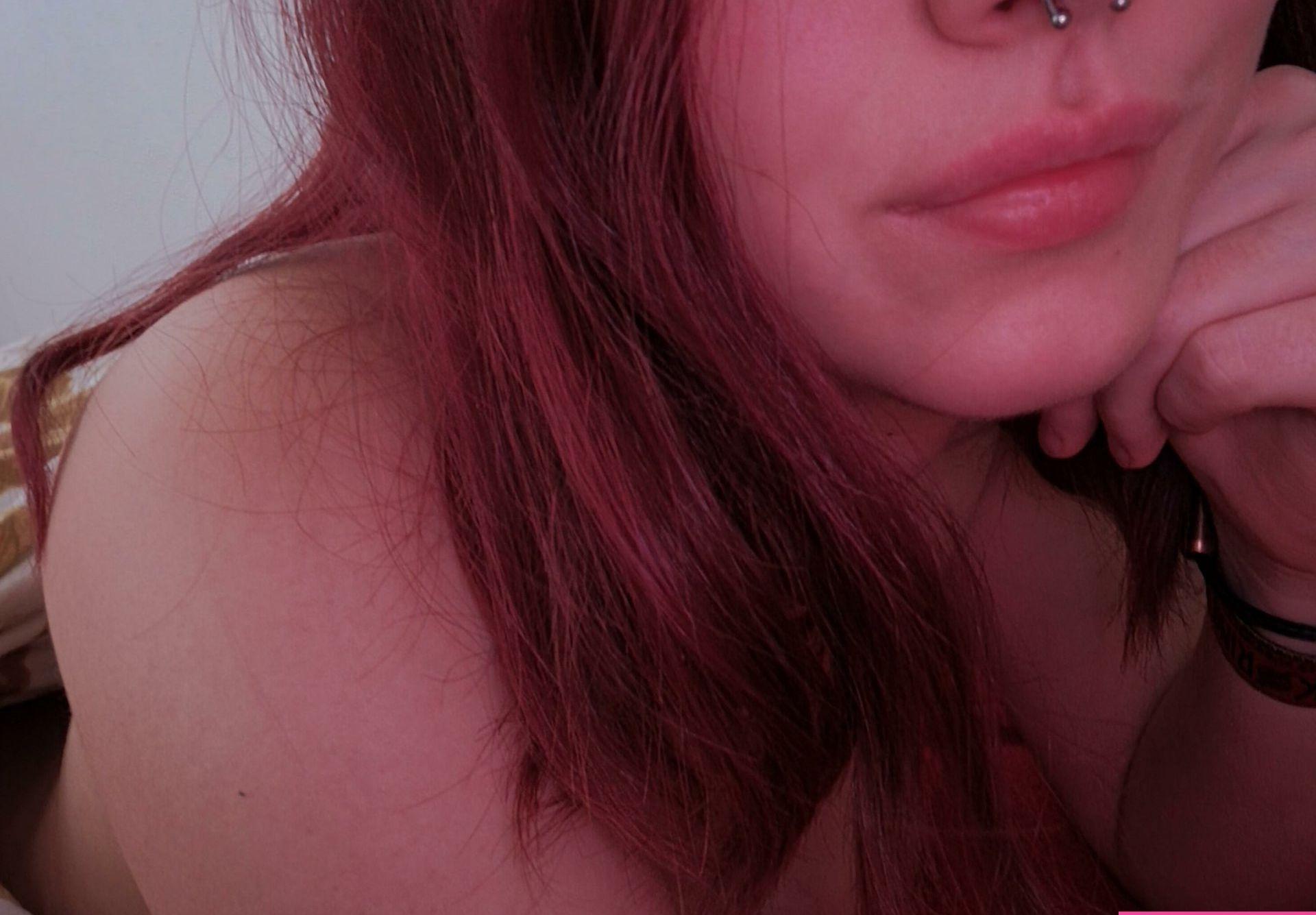 25P Vitiligo95 nude