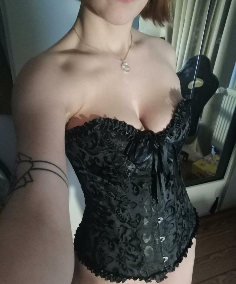 25P Vitiligo95 nude