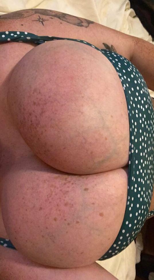25P YungFreckz nude