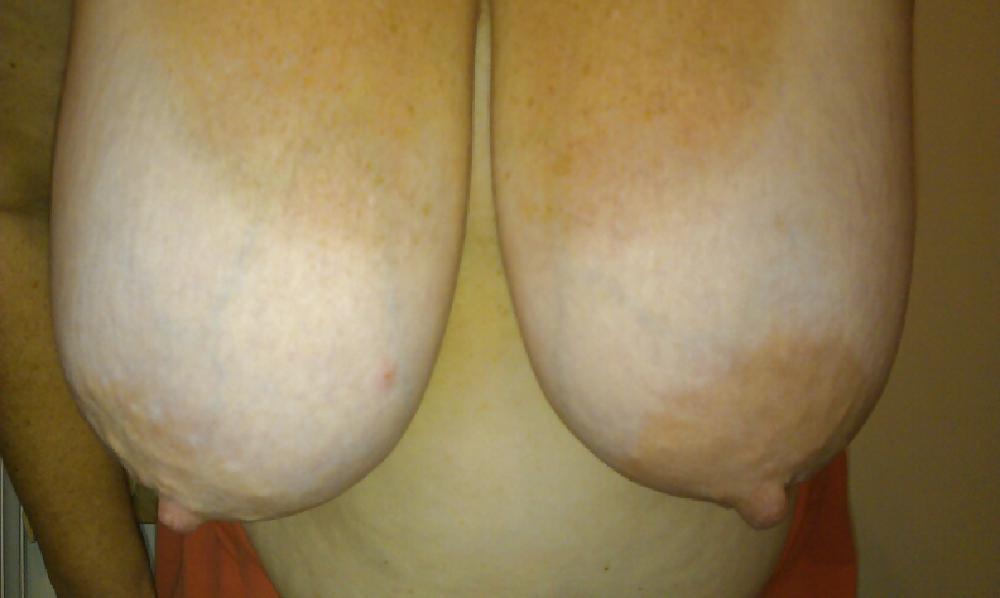 5P More Pictures of the Wifes Big Boobs