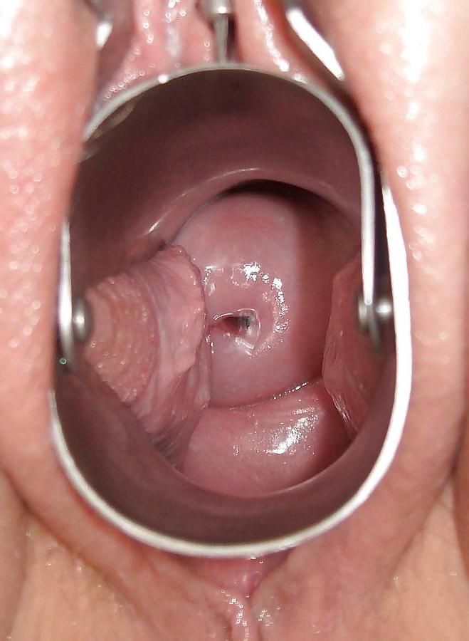 24P BG anal mix - II