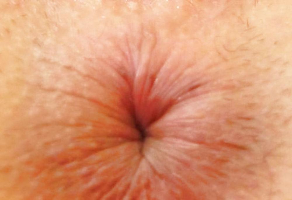 20P ANAL100% ANAL ENTERING THE TAIL