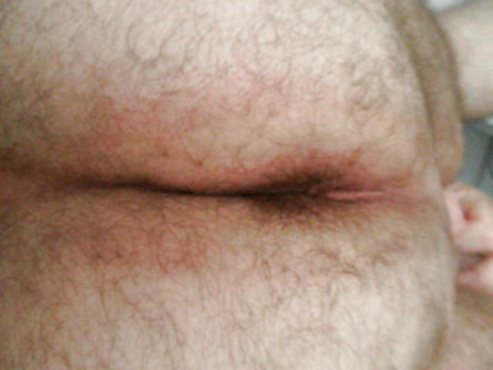 25P ANAL ANALE ASSES ASS