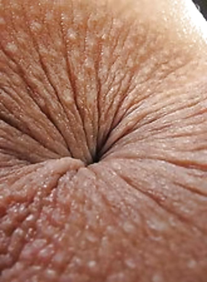 25P ANAL ANALE ASSES ASS