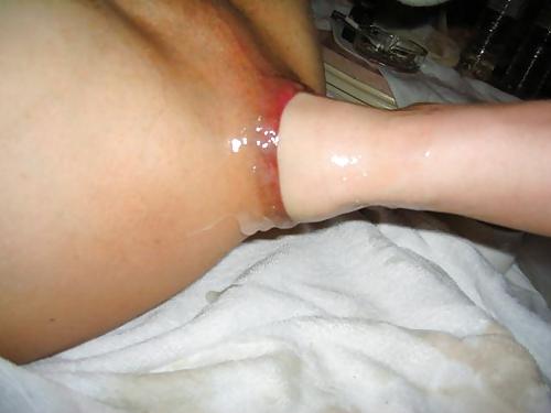 18P Anal fist!