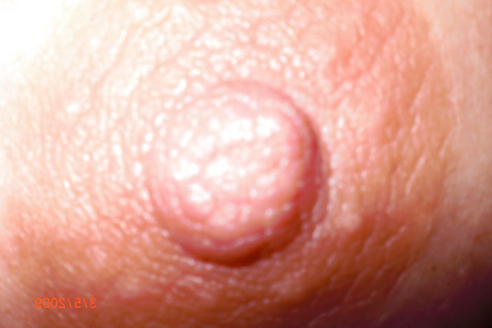 25P German Saggy Tits 