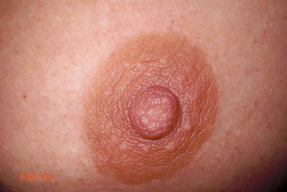 25P German Saggy Tits 