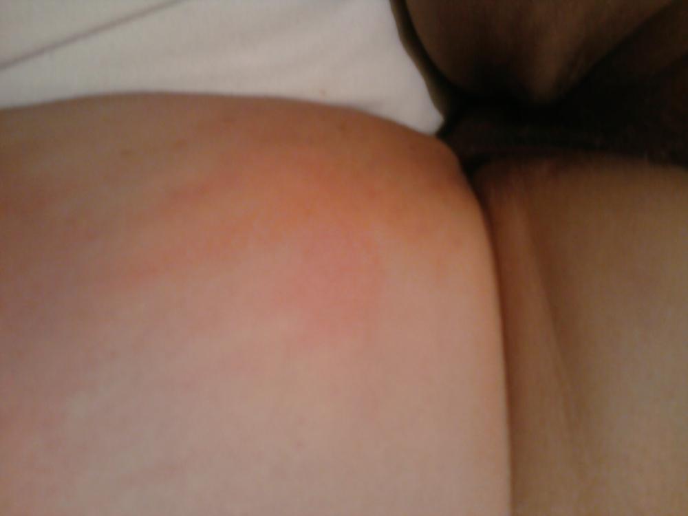8P Photos my Master took of me after a good spanking