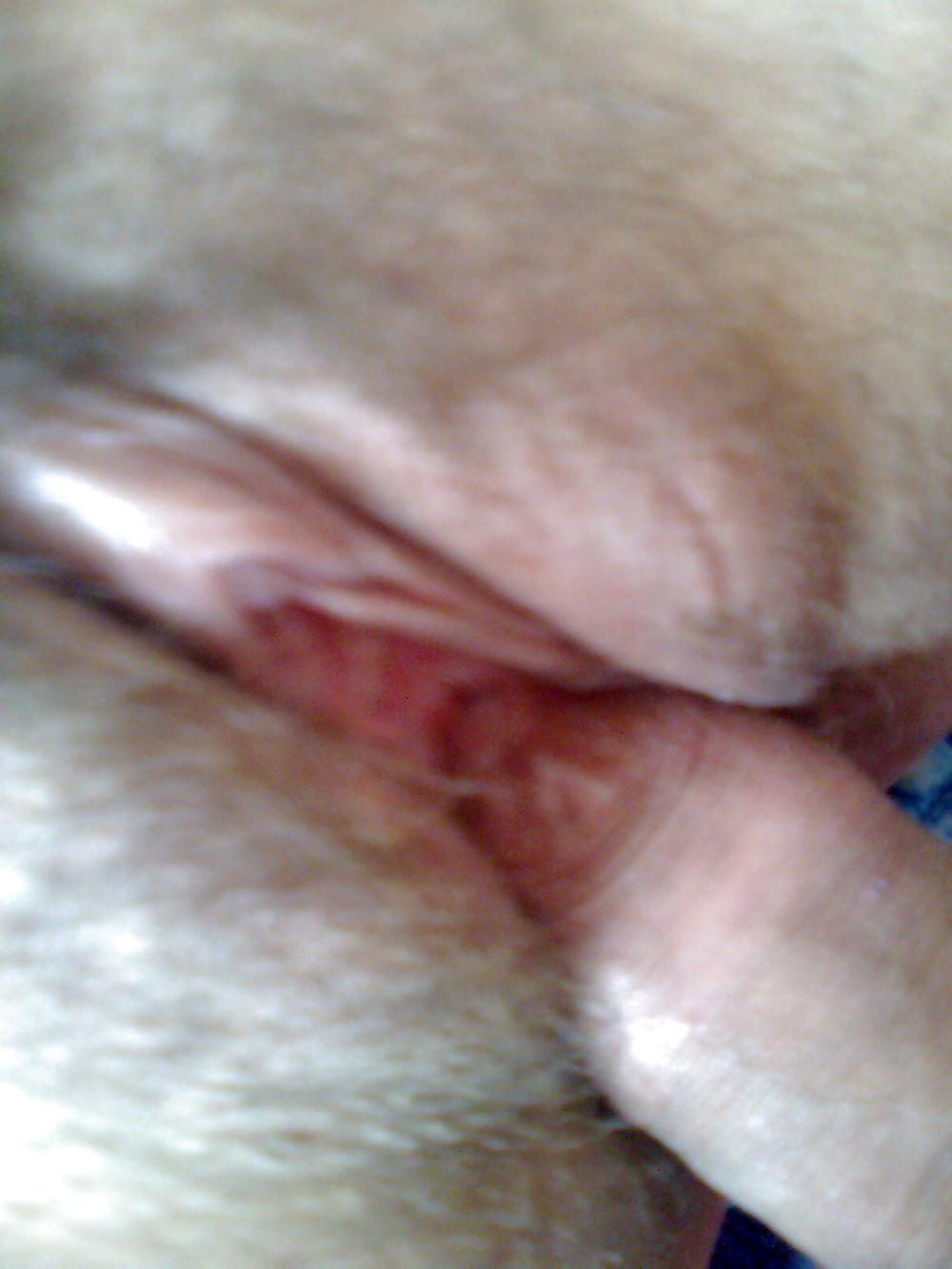 19P The story of one sex