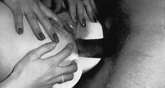 22P Anal Erotica - Supersex
