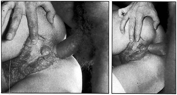 22P Anal Erotica - Supersex