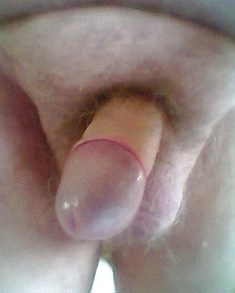 5P Just a few more pics
