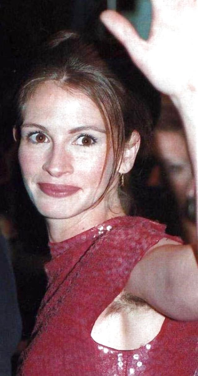 10P Julia Roberts (Hairy)