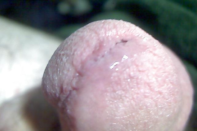 20P Some close ups of my cock