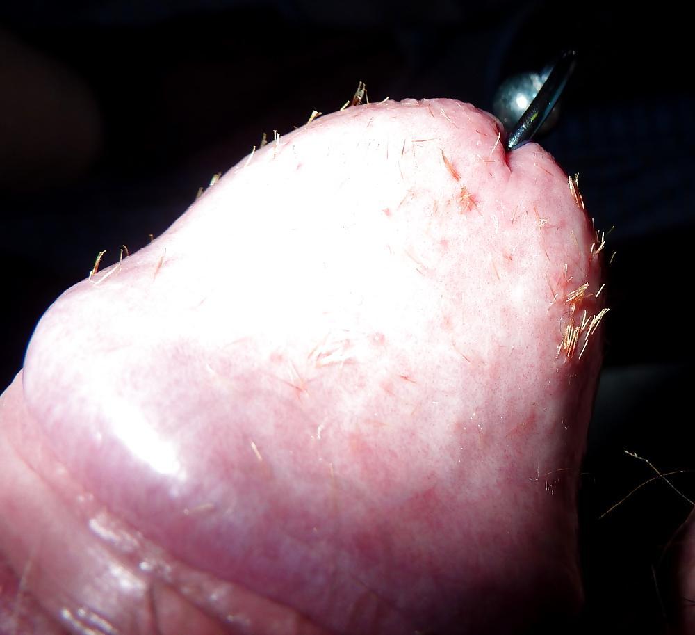 8P Pierced cock with hundreds of splinters in glans