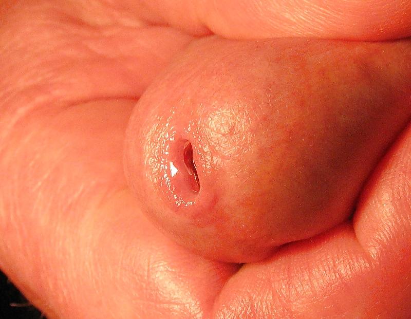 25P Cock lips on super macro... with sounding!