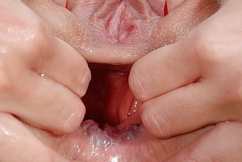 19P Anus-Anal-Rectum Gapes2