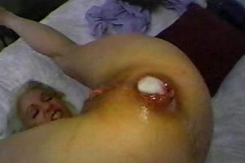 20P Cum and Prolapse
