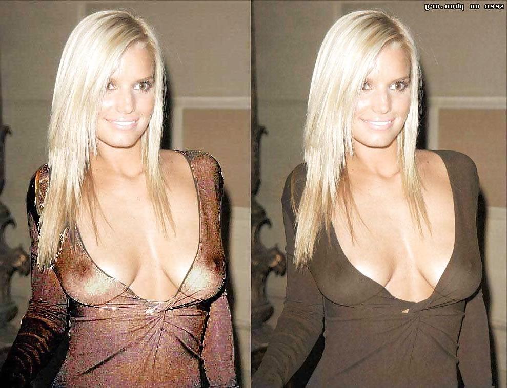 16P Celebrity X-Ray