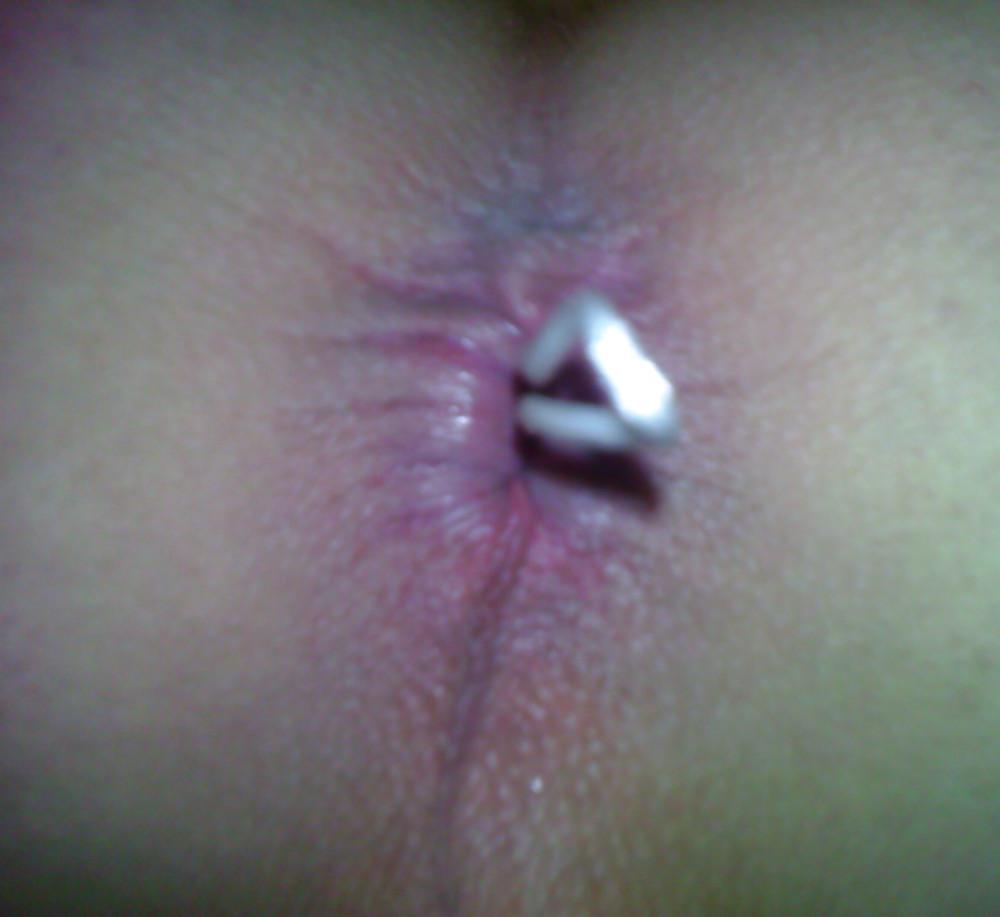 6P Anal beads