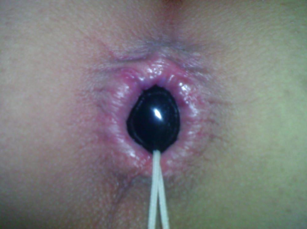 6P Anal beads