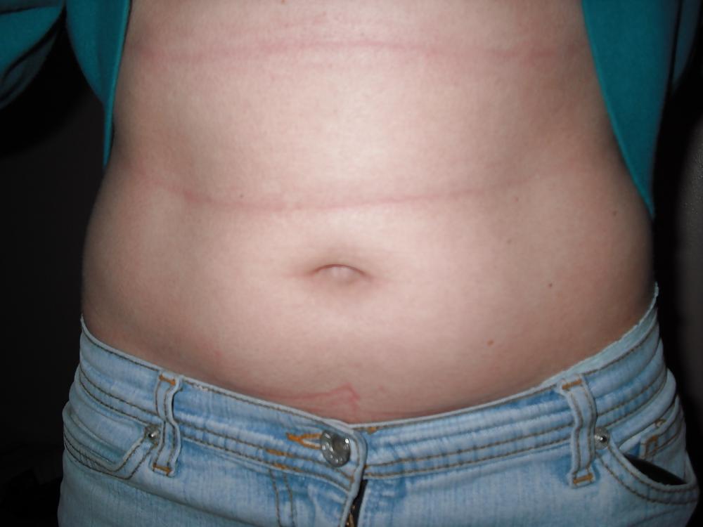 16P Innys & pierced Bellybuttons